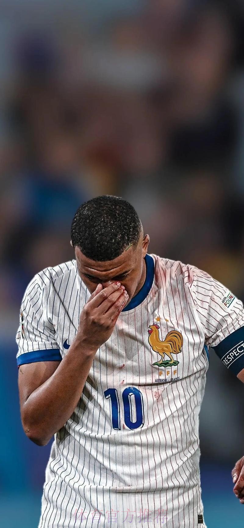 皇马担心姆巴佩鼻子骨折影响亮相 希望他接受手术 皇马担心姆巴佩鼻子骨折影响亮相 希望他接受手术